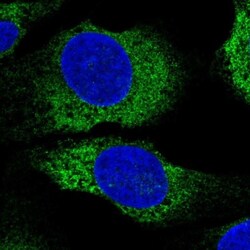 MYLK2 Antibody, Novus Biologicals 0.1mL; Unlabeled:Antibodies, Polyclonal