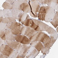 MYLK2 Antibody, Novus Biologicals 0.1mL; Unlabeled:Antibodies, Polyclonal
