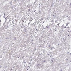 MYLK2 Antibody, Novus Biologicals 0.1mL; Unlabeled:Antibodies, Polyclonal