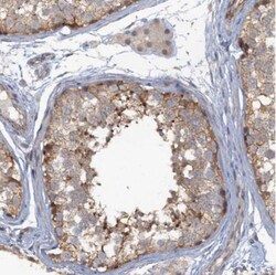 MYO16 Antibody, Novus Biologicals 0.1mL; Unlabeled:Antibodies, Polyclonal