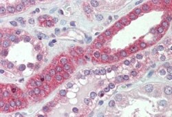 MYO1H Antibody, Novus Biologicals 0.1mg; Unlabeled:Antibodies, Polyclonal