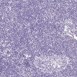 MYO6 Antibody, Novus Biologicals 0.1mL; Unlabeled:Antibodies, Polyclonal