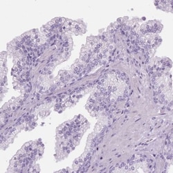 CLIP170 Antibody, Novus Biologicals:Antibodies:Primary Antibodies