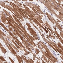 MYOM1 Antibody, Novus Biologicals:Antibodies:Primary Antibodies