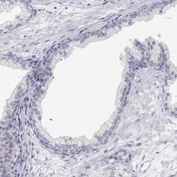 MYPN Antibody, Novus Biologicals 0.1mL; Unlabeled:Antibodies, Polyclonal