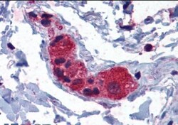 MYRIP Antibody, Novus Biologicals 0.1mg; Unlabeled:Antibodies, Polyclonal