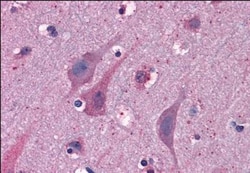 MYRIP Antibody, Novus Biologicals 0.1mg; Unlabeled:Antibodies, Polyclonal