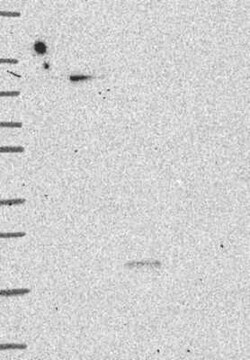 MYSM1 Rabbit anti-Human, Polyclonal, Novus Biologicals:Antibodies:Primary