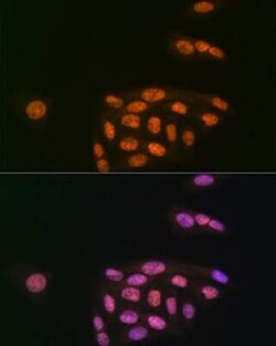 MYST1 Rabbit anti-Human, Mouse, Clone: 6U5Z6, Novus Biologicals 100 &mu;g;