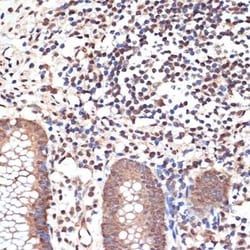MYST1 Rabbit anti-Human, Mouse, Clone: 6U5Z6, Novus Biologicals 100 &mu;g;