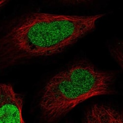 Macro H2A.2 Antibody, Novus Biologicals:Antibodies:Primary Antibodies