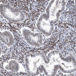 Macro H2A.2 Antibody, Novus Biologicals 25 &mu;L, Unconjugated:Antibodies,