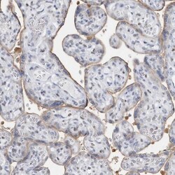 Macro H2A.2 Antibody, Novus Biologicals 25 &mu;L, Unconjugated:Antibodies,