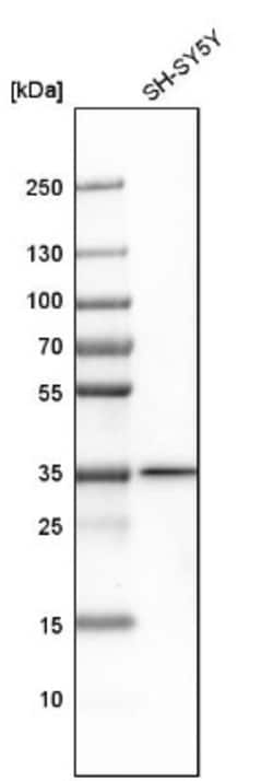 Macro H2A.2 Antibody, Novus Biologicals 25 &mu;L, Unconjugated:Antibodies,