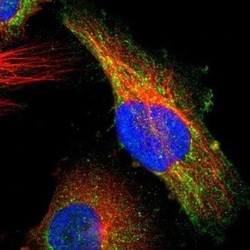 Mad Antibody, Novus Biologicals 25 &mu;L, Unconjugated:Antibodies, Polyclonal