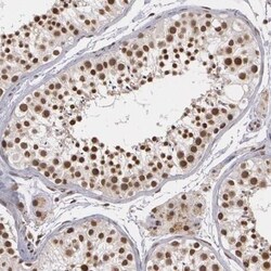 Mad Antibody, Novus Biologicals 25 &mu;L, Unconjugated:Antibodies, Polyclonal