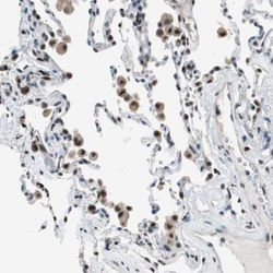MafB Antibody, Novus Biologicals 0.1mL; Unlabeled:Antibodies, Polyclonal