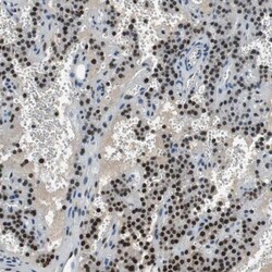 MafB Antibody, Novus Biologicals 0.1mL; Unlabeled:Antibodies, Polyclonal
