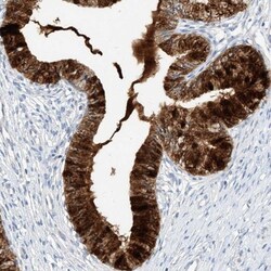 Mammaglobin B Antibody, Novus Biologicals 0.1mL; Unlabeled:Antibodies,