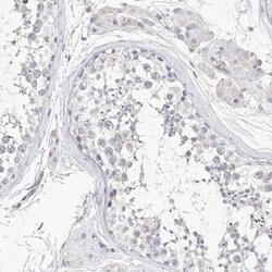 Mammaglobin B Antibody, Novus Biologicals 0.1mL; Unlabeled:Antibodies,