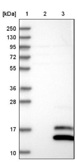 Mammaglobin B Antibody, Novus Biologicals 0.1mL; Unlabeled:Antibodies,