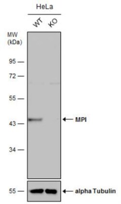 Mannose Phosphate Isomerase Antibody, Novus Biologicals 0.1mg; Unlabeled:Antibodies,