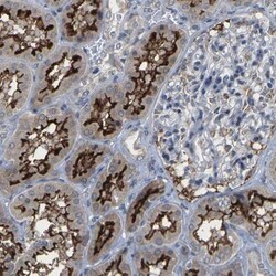 Map17 Antibody, Novus Biologicals 25 &mu;L; Unlabeled:Antibodies, Polyclonal