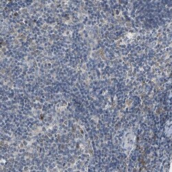 Map17 Antibody, Novus Biologicals 25 &mu;L; Unlabeled:Antibodies, Polyclonal