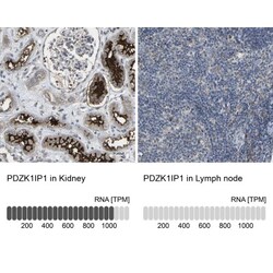 Map17 Antibody, Novus Biologicals 25 &mu;L; Unlabeled:Antibodies, Polyclonal