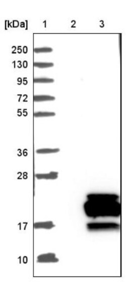Map17 Antibody, Novus Biologicals 25 &mu;L; Unlabeled:Antibodies, Polyclonal