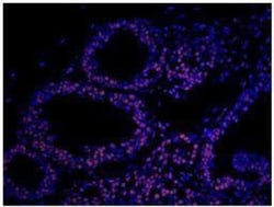Matrin 3 Antibody, Novus Biologicals 0.1mL; Unlabeled:Antibodies, Polyclonal