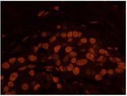Matrin 3 Antibody, Novus Biologicals 0.1mL; Unlabeled:Antibodies, Polyclonal