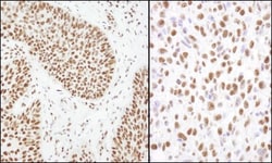 Matrin 3 Antibody, Novus Biologicals 0.1mL; Unlabeled:Antibodies, Polyclonal