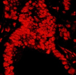 Matrin 3 Antibody, Novus Biologicals 0.1mL; Unlabeled:Antibodies, Polyclonal