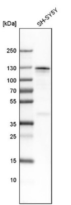 Matrin 3 Antibody, Novus Biologicals 25 &mu;L | Buy Online | Novus Biologicals | Fisher Scientific