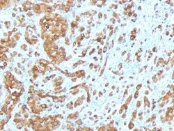 Melan-A/MART-1 Antibody (MLANA/788), Novus Biologicals 0.2 mg | Buy Online | Novus Biologicals | Fisher Scientific