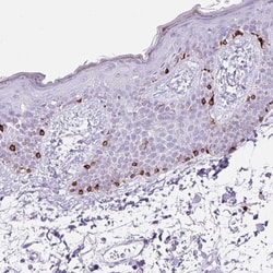 Melan-A/MART-1 Antibody, Novus Biologicals 25 &mu;L | Buy Online | Novus Biologicals | Fisher Scientific