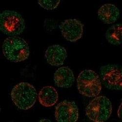 Melanoma Antigen Family B16 Rabbit anti-Human, Polyclonal, Novus Biologicals