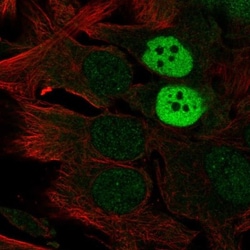 Melanoma antigen family C2 Antibody, Novus Biologicals:Antibodies:Primary