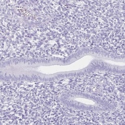 Melanoma antigen family C2 Antibody, Novus Biologicals:Antibodies:Primary