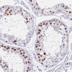 Melanoma antigen family C2 Antibody, Novus Biologicals:Antibodies:Primary