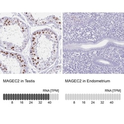 Melanoma antigen family C2 Antibody, Novus Biologicals:Antibodies:Primary