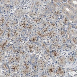 Melanotransferrin/CD228/MFI2 Antibody, Novus Biologicals:Antibodies:Primary