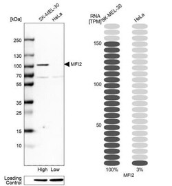 Melanotransferrin/CD228/MFI2 Antibody, Novus Biologicals:Antibodies:Primary