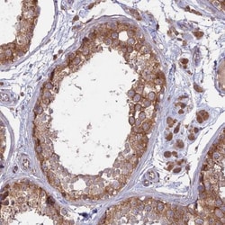 Membralin Antibody, Novus Biologicals:Antibodies:Primary Antibodies