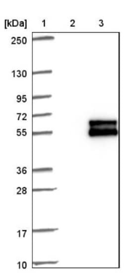 Membralin Antibody, Novus Biologicals:Antibodies:Primary Antibodies