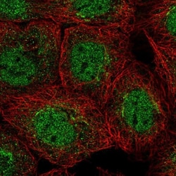 Membrin Antibody, Novus Biologicals 25 &mu;L; Unlabeled:Antibodies, Polyclonal
