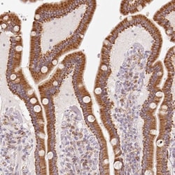 Membrin Antibody, Novus Biologicals 25 &mu;L; Unlabeled:Antibodies, Polyclonal