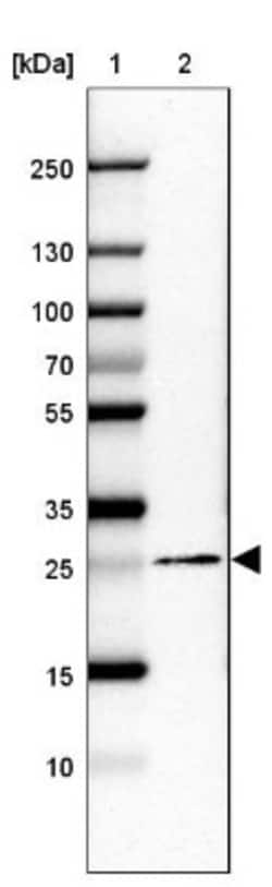 Membrin Antibody, Novus Biologicals 25 &mu;L; Unlabeled:Antibodies, Polyclonal