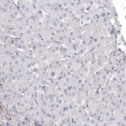 Mena Antibody, Novus Biologicals 0.1mL; Unlabeled:Antibodies, Polyclonal